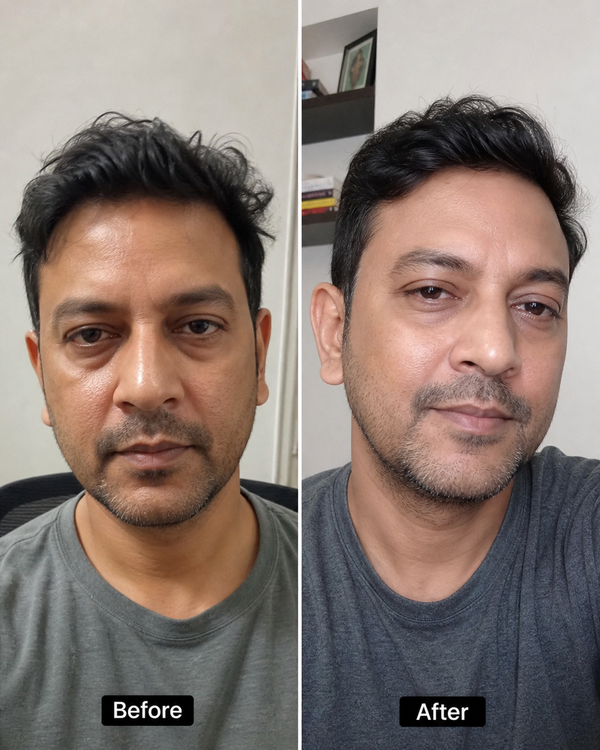 Before and after