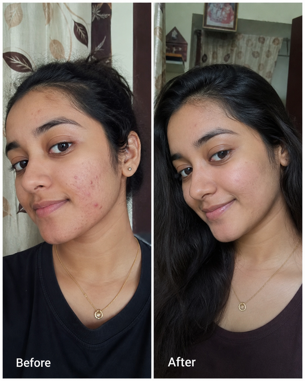 Before and after