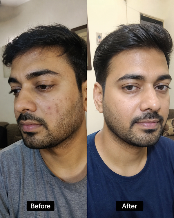 Before and after