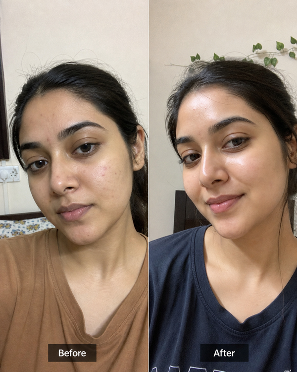 Before and after